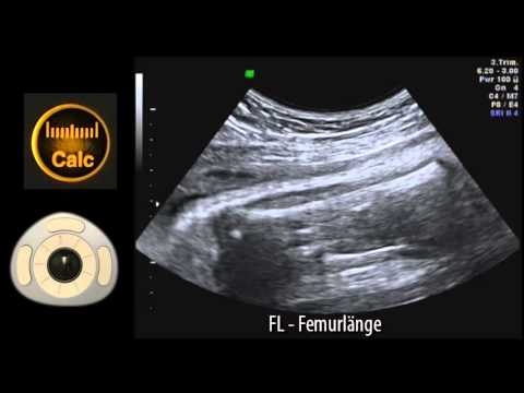 Video: Was ist fetale Biometrie?