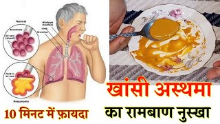 अस्थमा खांसी का असरदार उपचार | HOME REMEDIE FOR COUGH | Cough Medicine | Dry cough upchar.