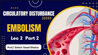 General Pathology 2 ; Lec 2 Part 2 ; Embolism