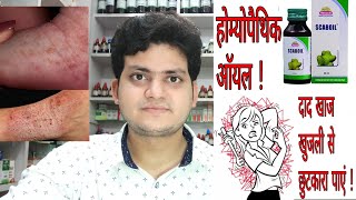 Homeopathic medicine for Itching ? खुजली की होम्योपैथिक दवा ! screenshot 2