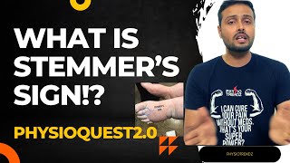 What is Stemmer's sign and How to Test it | PHYSIOQUEST 2.0
