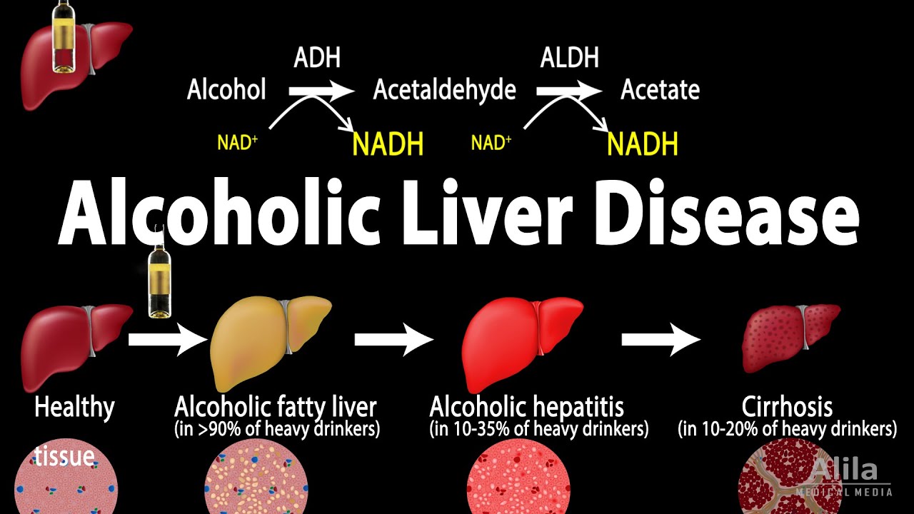 Cuanto tiempo tarda en irse el alcohol del cuerpo