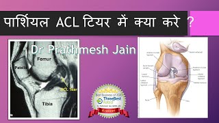 Everything about Partial ACL Tear in  Hindi