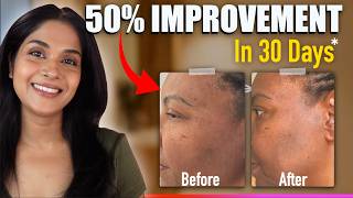 How Her Stubborn Pigmentation Became Clearer in Just 30 Days