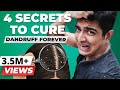 4 SECRET Tips to remove Dandruff Forever | BeerBiceps Health