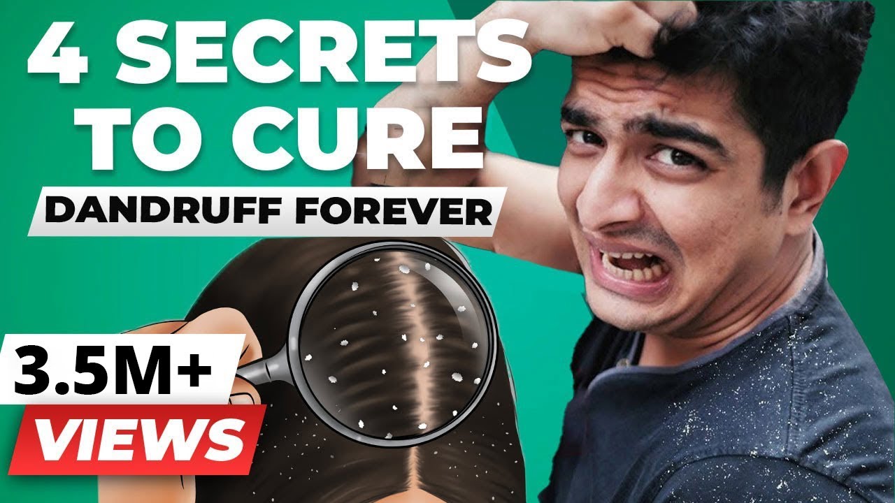 4 SECRET Tips To Remove Dandruff Forever | BeerBiceps Health