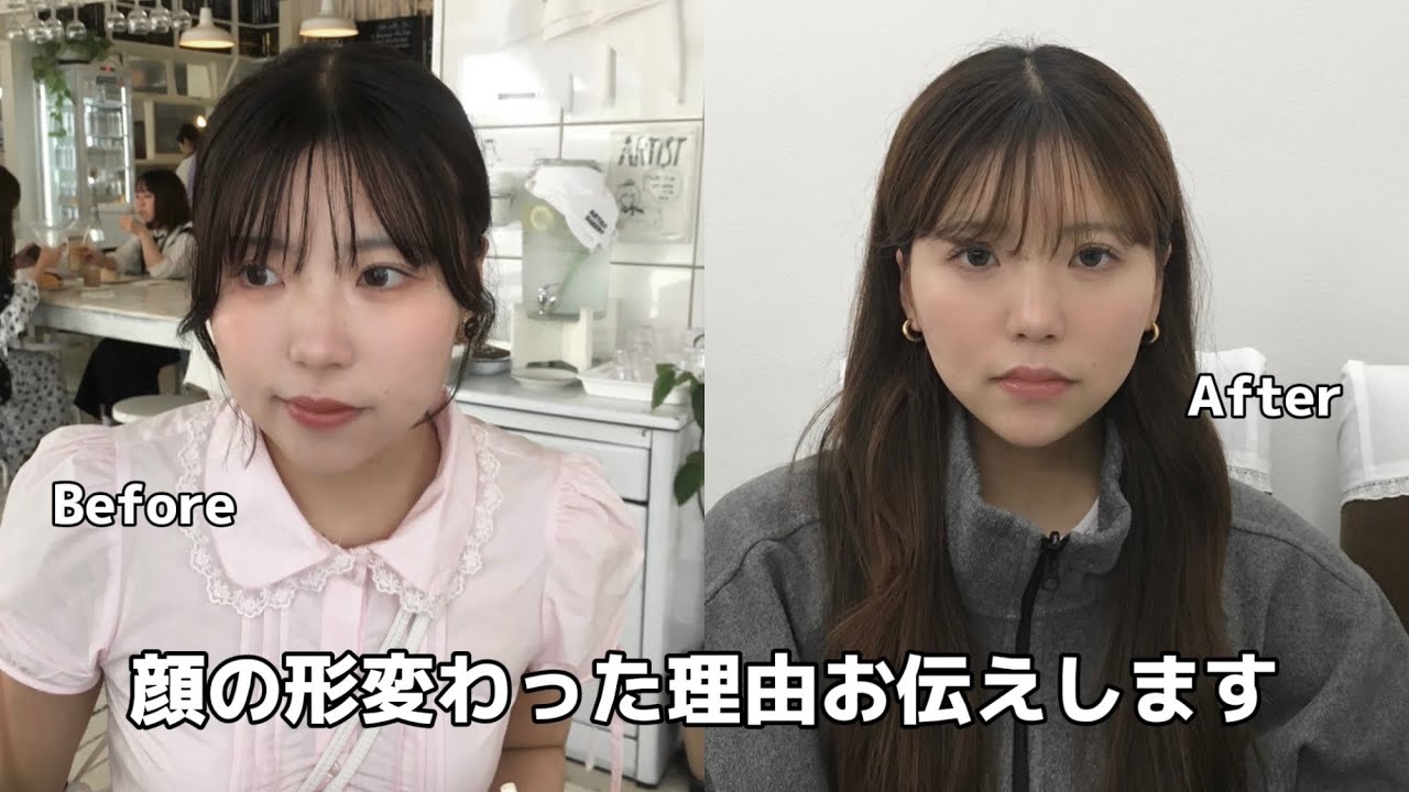 本当に顔が丸い人の小顔施術レポです