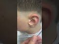 Asmr Ear Cleaning #earcleaningasmr #asmrearcleaning #earcleaning pt 001