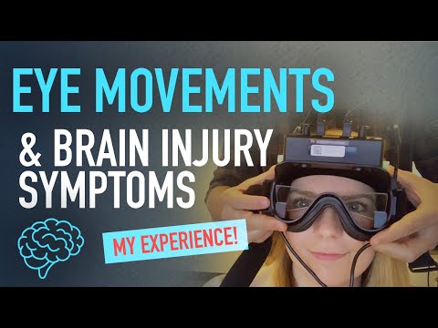 Using Eye Movements to find the Root Cause of Brain Injury Symptoms | My Experience