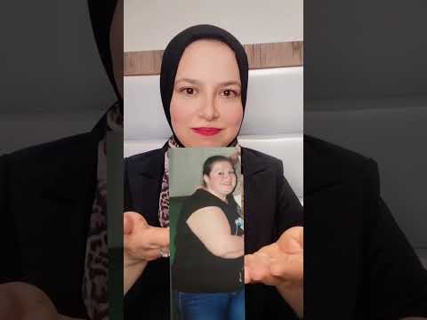 من 155 كيلو الي 75 كيلو يعني تحول بدون عمليات علشان تعرف تفاصيل تواصلي معي وتساب 966595080340