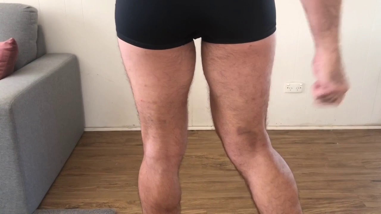 Hamstring Injury And Treatment Youtube