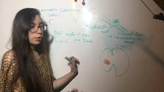 Versión Corta Hemorragia Intracerebral Etiología, Cuadro Clinico, Diagnóstico, Tratamiento