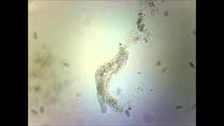 Time lapse Video : AMOEBA