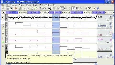 EEG Frequency Analysis