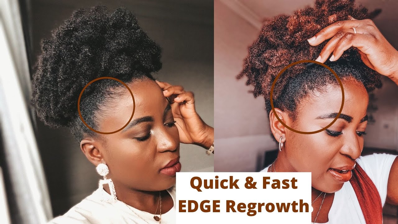 How I Grow my Edges Quick & Fast | Regrowz Hair Kit | Kenny Olapade