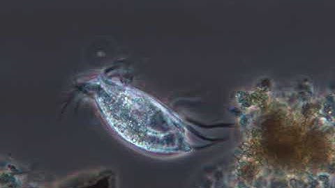 Eupoletes Protozoan with Altair Hypercam 294C Camera, Phase Contrast