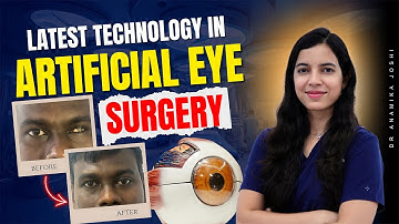 Latest technology in ARTIFICIAL EYE SURGERY - explained by an eye plastic surgeon | Dr Anamika joshi