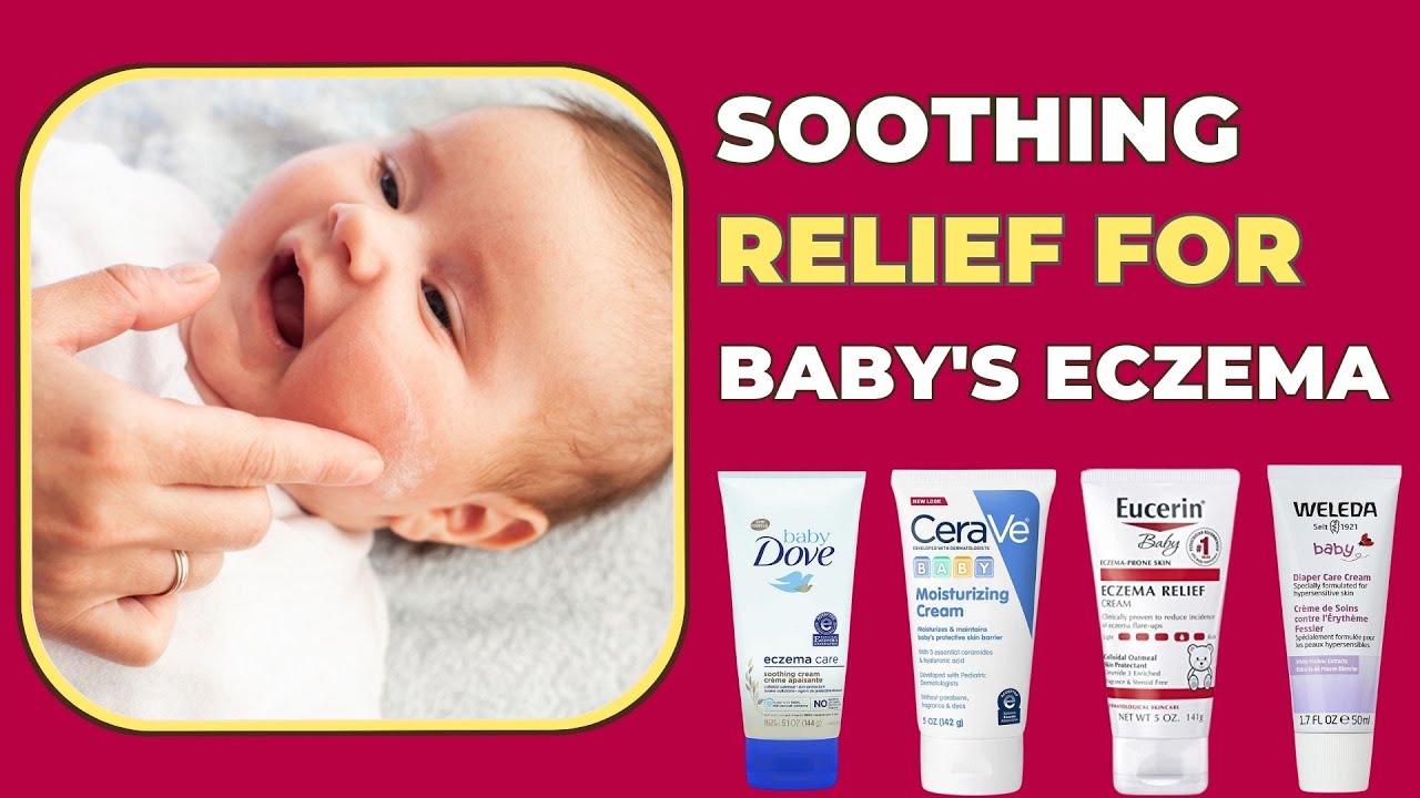 Best Eczema Creams For Babies Say Goodbye To Itchy, Irritated Skin YouTube