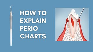 How to explain PERIO CHARTS