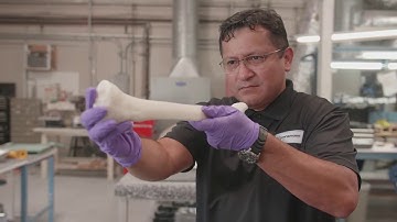 Dinsmore & CHOC Hospital - 3D Printed Tibia Bone