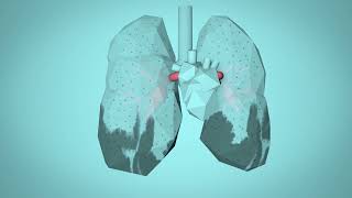 Module 4 Video recap: how air pollution impacts the body