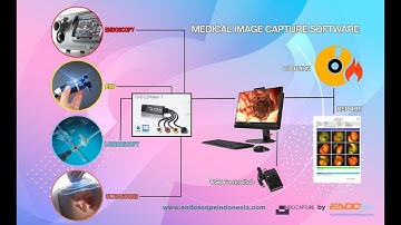 ENDOSCOPY CAMERA CAPTURE