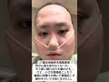 肺転移末期癌ステージⅣ抗がん剤治療が全く効いて無かった…治らず、生存率１割未満と宣告。それでも小さな奇跡を起こしました！#骨肉腫#05#おすすめ #ありがとう#いいね