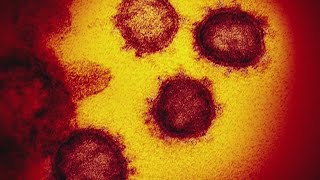The CDC relaxed its COVID-19 guidance. So what’s changed?