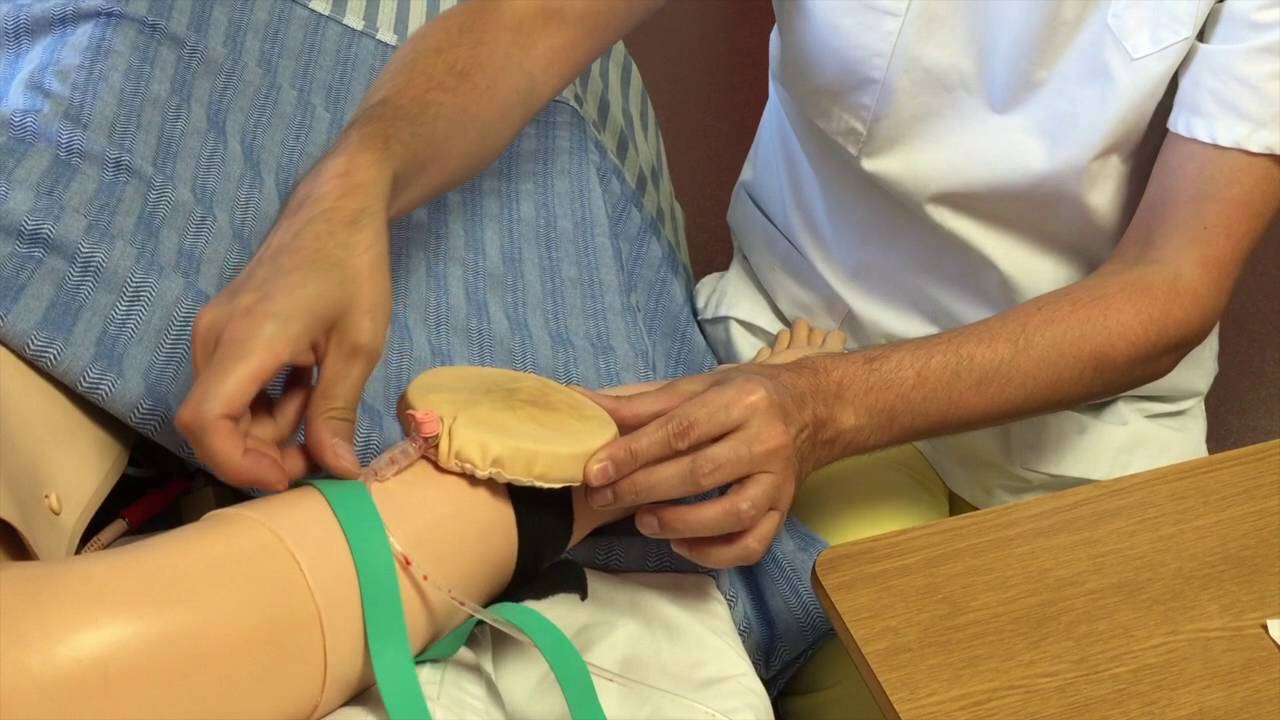 La pose de voie veineuse periphérique