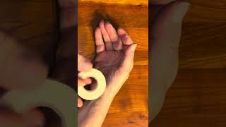 Trigger thumb non-surgical treatment 