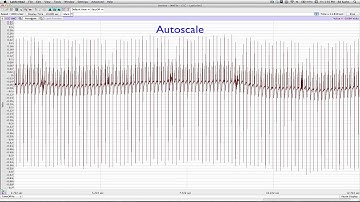 ECG 03 - ECG Recording