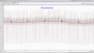 ECG 03 - ECG Recording screenshot 4