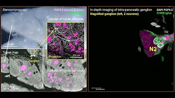 3D Airyscan of human intrapancreatic ganglion: the glial–neuronal association (1080p HD)