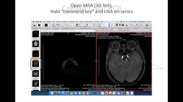 Osirix Meshlab processing
