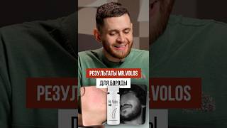 Борода с нуля в 15 лет!/Результат Mr.Volos