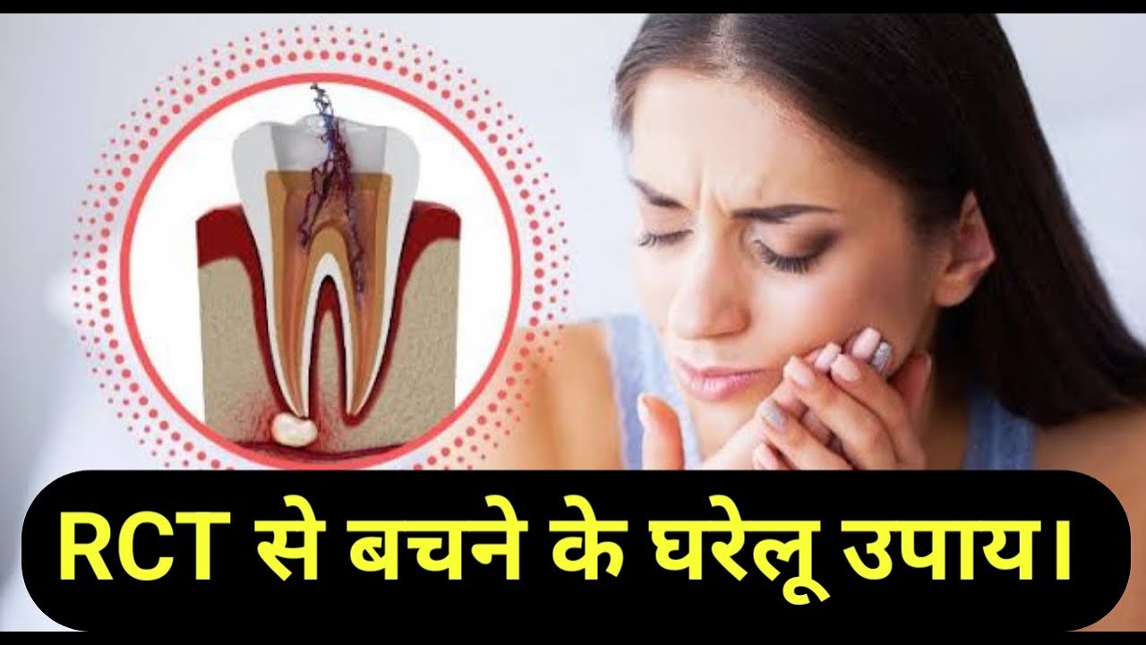 Bad Rct Examples RCT से बचने के घरेलू उपाय। Follow these to prevent RCT| root canal ...