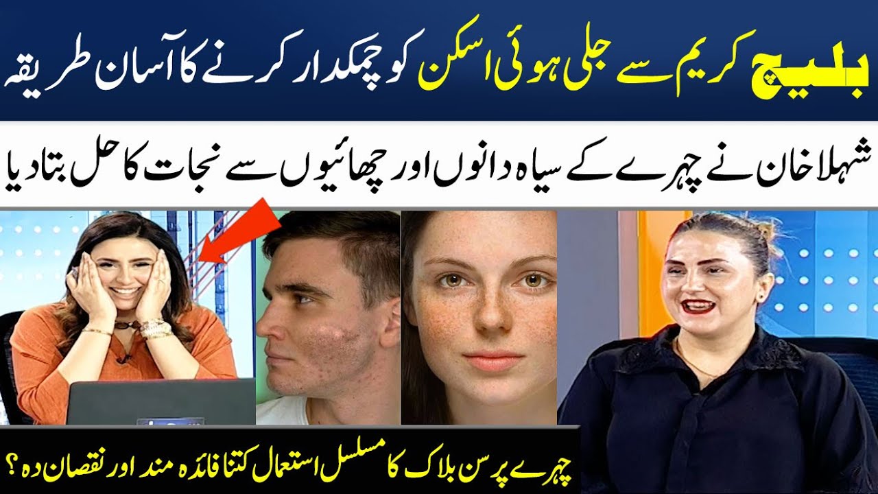 How to Remove Dark Spots & Pimples on Face? Bleach Skin Burn