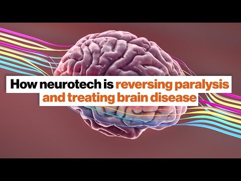 Neuroprosthetics and deep brain stimulation: Two big neuroscience breakthroughs | Susan Hockfield