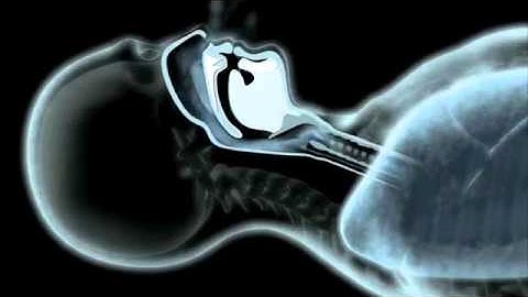 ResMed S9 Series:  Obstructive and Central Apneas