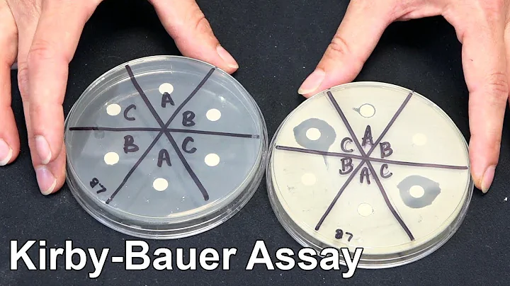 Kirby Bauer Assay - Techniques Demonstration