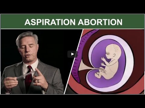 Video: Abortas Ir Testai