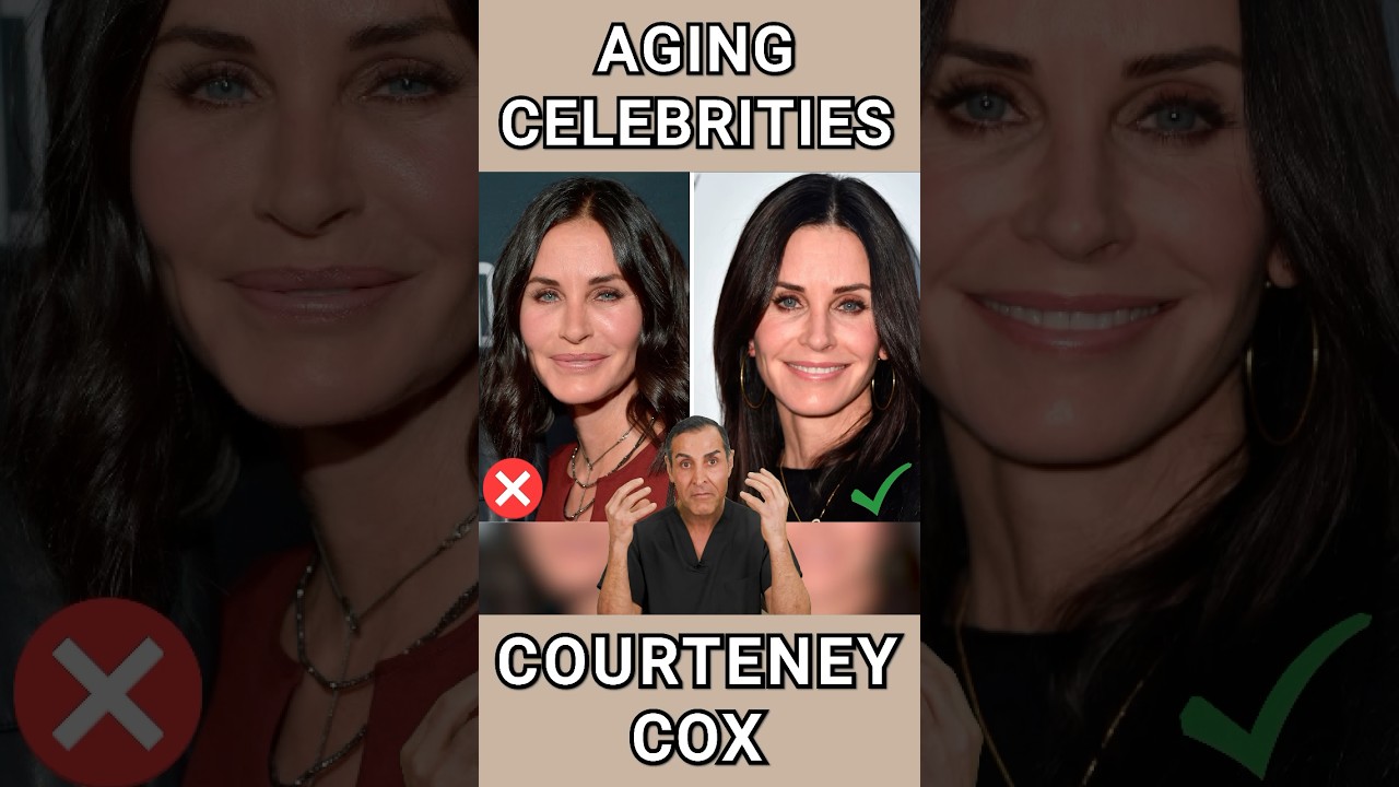 Plastic Surgeon Reacts to Courteney Cox’s Face #courteneycox #fillers #antiaging