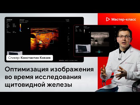 Оптимизация изображения во время исследования щитовидной железы