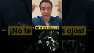 Mira Lo Que Pasa Cuando Tallas Tus Ojos . Créditos De La Rm Defeatkeratoconus