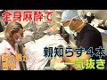 【親知らず抜歯】全身麻酔オペを謎の男に見られてしまった