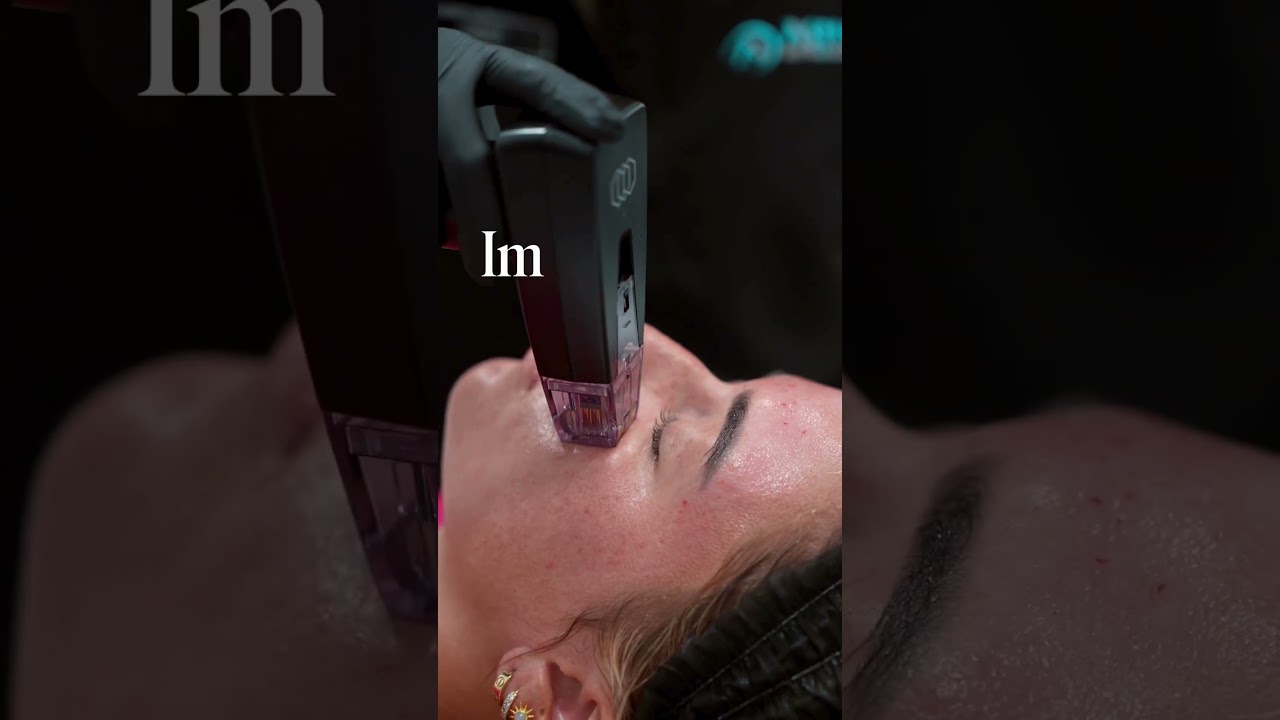 Healthy, prepped skin = better tightening, smoother texture, and optimal results for Morpheus8