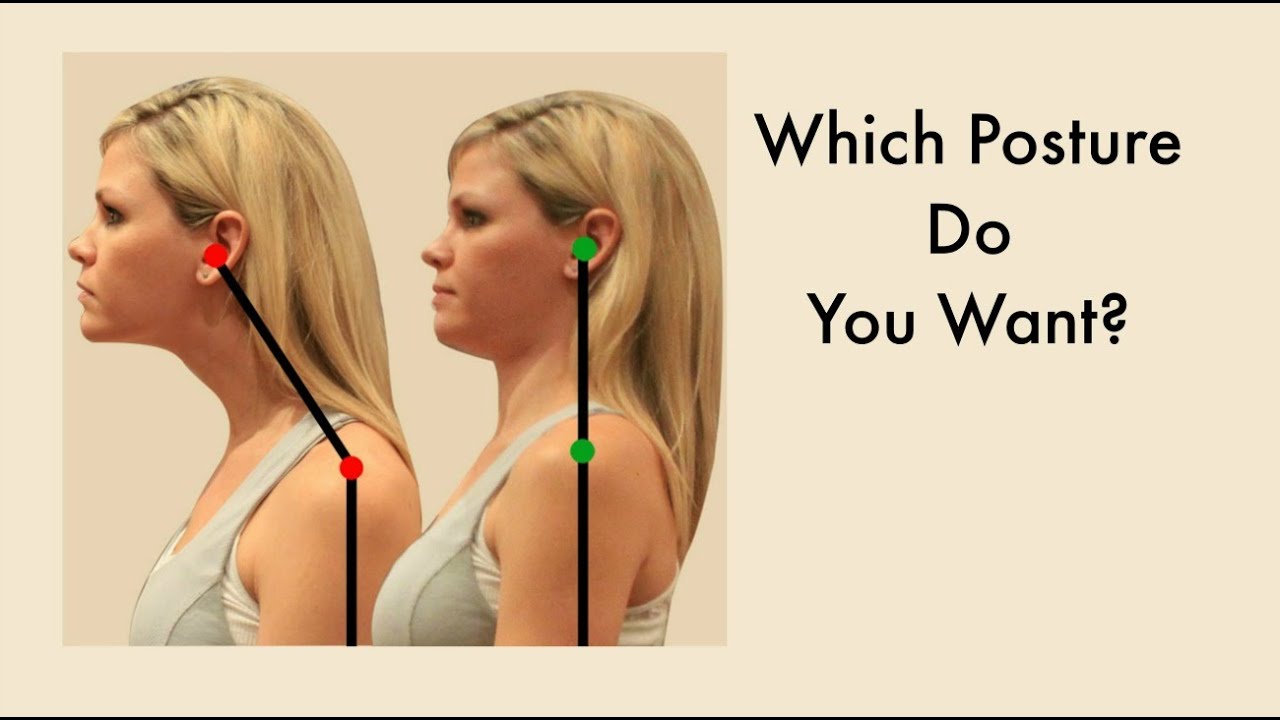 Forward Head Posture Correction Exercises - Fix Ugly Forward Head Posture Video #2 - YouTube