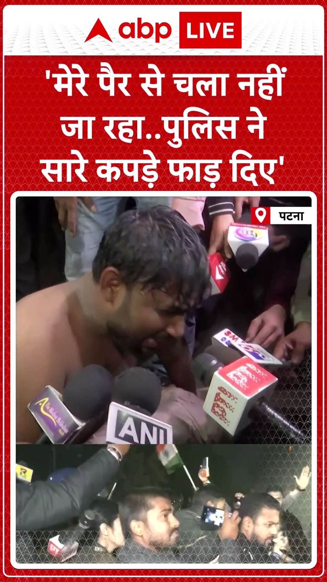 BPSC Protest: पीड़ित छात्र का आया बयान 'मेरे पैर से चला नहीं जा रहा.. पुलिस ने सारे कपड़े फाड़ दिए'