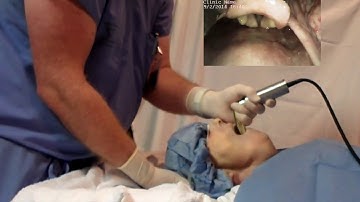 George Kovacs Head Lift Video