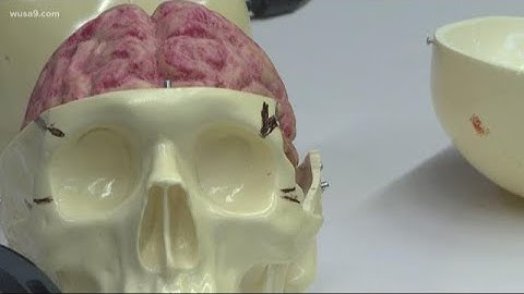 A team of researchers is building a virtual reality platform to help with brain surgery. Here’s how